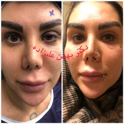 تصویر گالری بهمن علیزاده 6