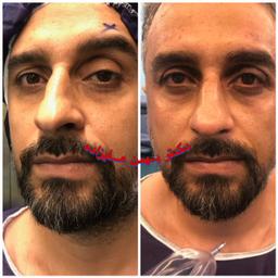 تصویر گالری بهمن علیزاده 2