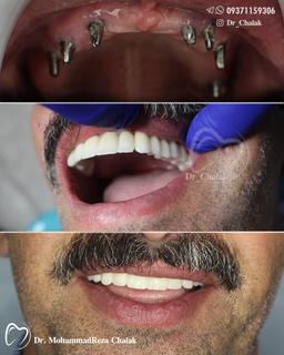 تصویر گالری محمدرضا چالاک 7