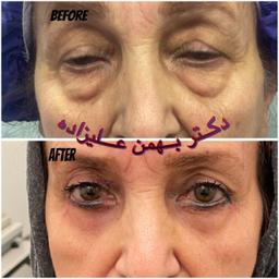 تصویر گالری بهمن علیزاده 16