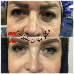تصویر گالری بهمن علیزاده 9