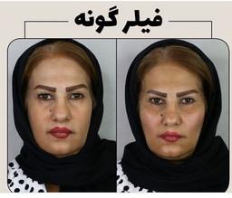 تصویر گالری رکسانا دهقانی 3